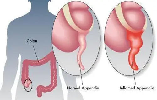 ǂ(g)zcǷ񝓲֪Ľܴa