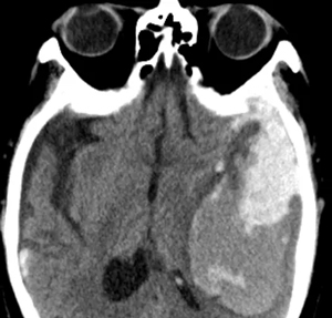 °l(f)ͻȻ҈F(tun)(du)(zhn)΢(chung)ݑ(yng)(du)(f)