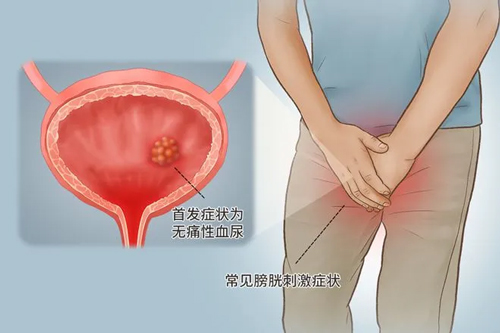 馬桶里的“紅色預(yù)警”,原因竟是.... 馬桶里的“紅色預(yù)警”,原因竟是....