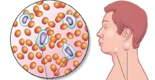 滾蛋吧!腫瘤君 滾蛋吧!腫瘤君